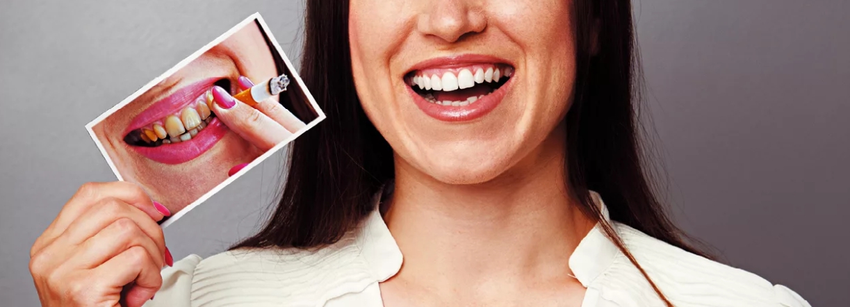 Отбеливание зубов от сигарет американские зубные пасты купить в москве