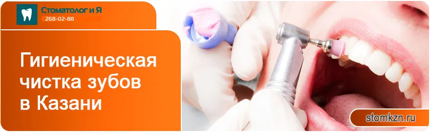 Гигиеническая чистка зубов в Казани от «Стоматолог и Я». 