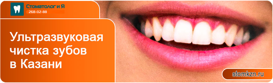 Ультразвуковая чистка зубов в Казани от «Стоматолог и Я». Наши специалисты выполнят ультразвуковую чистку зубов быстро и безболезненно. 