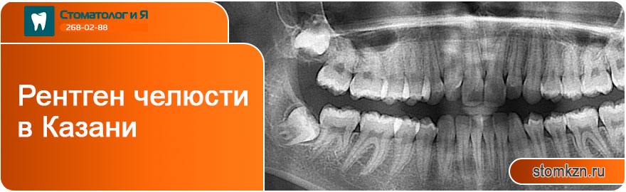 Рентген челюсти в Казани от «Стоматолог и Я». Производится на высококачественном оборудовании. 