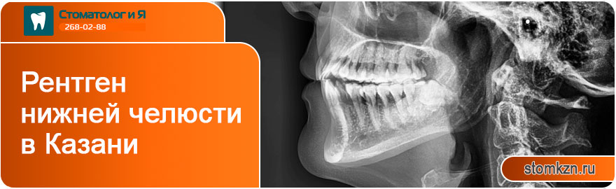 Рентген нижней челюсти в Казани от «Стоматолог и Я». Производится на высококачественном оборудовании. 