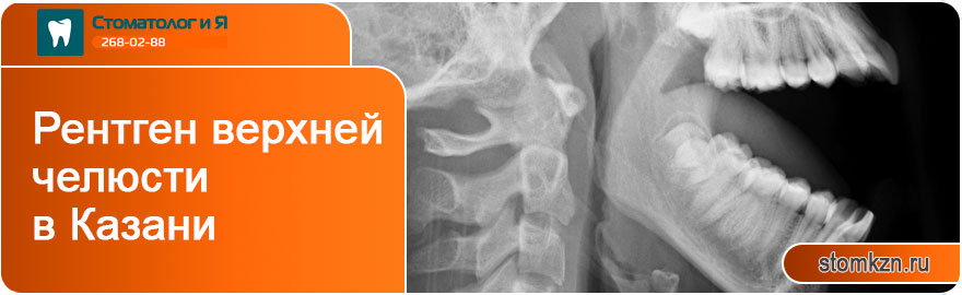 Рентген верхней челюсти в Казани от «Стоматолог и Я». Производится на высококласном оборудовании.