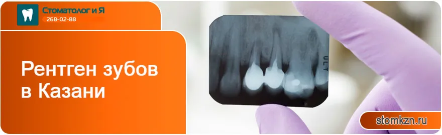 Рентген зубов в Казани от «Стоматолог и Я». На высококачественном оборудовании. 